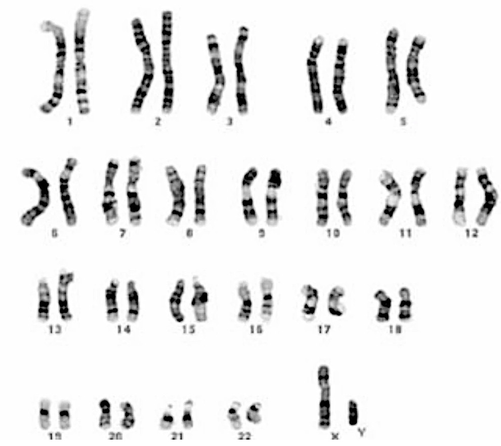G-banded human metaphase chromosomes