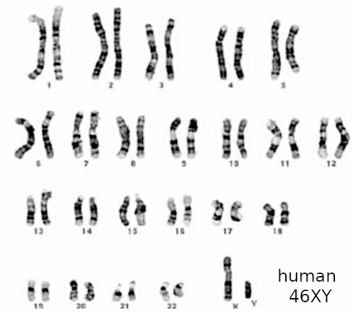 G-banded human karyotype, male, 46XY