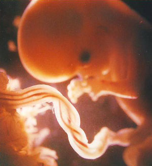 human embryo